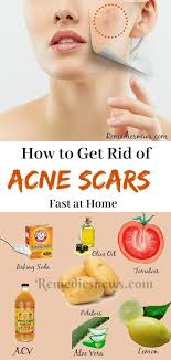 Pin On Natural Cure