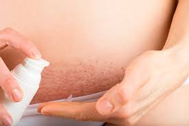 Hautveränderungen im Genitalbereich