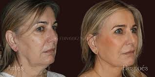 Dr. Alfredo Fernández Blanco