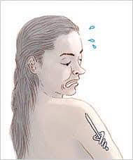 There is an increase in both the number of people getting tattoos and the number of skin cancers, so invariably there will be skin cancers that will develop in a tattoo. The Claim Tattoos Can Increase The Risk Of Skin Cancer The New York Times