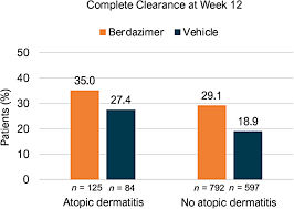 Image result for Berdazimer