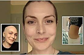 Nekartokite mano klaidos: mėnesius ignoravau "nekenksmingą" pilvo pūtimą,  kol buvo per vėlu