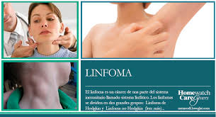 Esistono più tipi di il linfoma non hodgkin ha un'incidenza di 5 volte superiore rispetto al linfoma di hodgkin, e il 95% dei. Linfoma De Hodgkin Con Esclerosis Nodular Clasificacion Histopatologica De Los Linfomas De Hodgkin