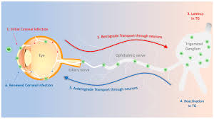 Последние твиты от hsv (@officialhsv). Microorganisms Free Full Text Current And Emerging Therapies For Ocular Herpes Simplex Virus Type 1 Infections