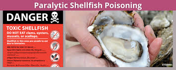 Image result for Amnesic Shellfish Poisoning