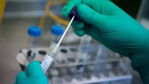 Nachrichten und information zum sars cov 2, den symptomen, schutzmaßnahmen und dem weltweiten kampf gegen die pandemie. Medics Face Daunting Task To Test All Coronavirus Cases Financial Times
