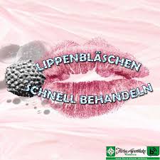 Viele menschen wenden homöopathische globuli bei herpes an. Herpes Lippenblaschen Schnell Behandeln Flora Apotheke Hannover