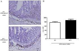 A Immunohistochemical Staining Of F4 80 Positive Macrophages Download Scientific Diagram