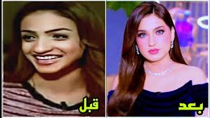‫شاهدوا 30 فنانة قبل وبعد عمليات التجميل لن تصدقوا أعينكم شاهدوا كيف كانوا  وكيف أصبحوا(الجزء الرابع ) - YouTube‬‎