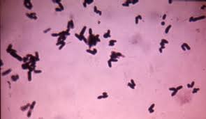 Image result for Corynebacterium