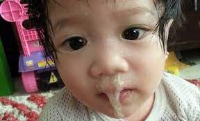 Batuk akut biasanya timbul mendadak akibat masuk angin, influenza, atau infeksi sinus (sinusitis). Tips Melegakan Selsema Dan Batuk Berkahak Bayi Dengan Cepat
