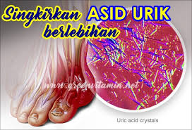 Ada banyak ubat yang boleh membantu mengurangkan kesakitan ini. Panduan Dan Tips Kesihatan Vitamin Semulajadi