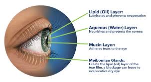 Image result for Dry Eye