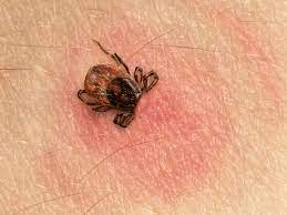The longer a tick remains embedded. Tick Bite Pictures Symptoms What Does A Tick Bite Look Like