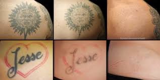 Using the different wavelengths, the various pigment colors are targeted. Permanent Makeup Removal At Home Saubhaya Makeup