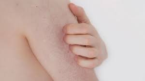 ما هوالتقرن الشعري و كيف يتم علاجه keratosis pilaris dry body brushing dry brushing