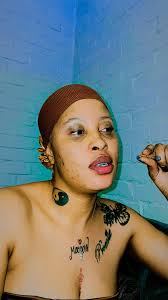 How do I get rid of my blackheads all over my face