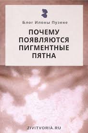 как убрать пигментные пятна на лице в домашних условиях Prichiny Poyavleniya Pigmentnyh Pyaten Na Kozhe Pyatna Lico Chistoe Lico
