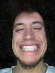 Howard J Lerner, DMD, 124 E 40th St, Rm 302, New York, NY 10016, US