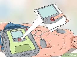 The use of paddles is still common in many european countries 111213, however, it is not known what the most common defibrillation. How To Use A Defibrillator 11 Steps With Pictures Wikihow