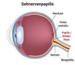 Stauungspapille Ursache Symptome Behandlung Aumedo