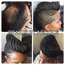 14 Extraordinary Alopecia Camouflage Cornrows By Braids By Necole Braids For Thin Hair Braided Hairstyles Updo Braids For Short Hair