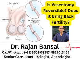 Image result for Vasectomy