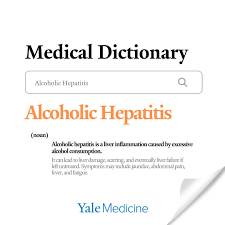 Image result for Maddrey Discriminant Function