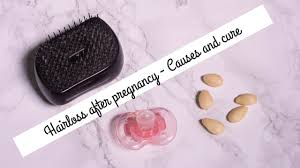 During pregnancy, your high levels of estrogen prevented your usual rate of hair loss. Hairloss After Pregnancy Causes And Cure Youtube