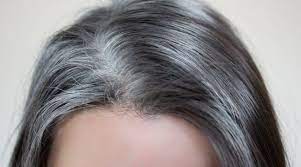 An autoimmune disease is a condition in which the immune system attacks the body's own healthy cells for an unknown reason ( 16 ). White And Dry Hairs Problem Medimetry Consult Doctor Online