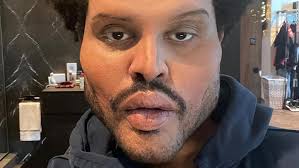 He had a similar look at the 2020 mtv vmas. The Weeknd S Face Freaks Some People Out Cnn