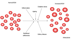 See full list on verywellhealth.com Pathophysiological Mechanisms Causing Anisocytosis Rdw Red Blood Cell Download Scientific Diagram