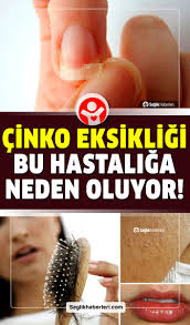 Cinko Eksikligi Hangi Hastaliklara Yol Acar Cinko Deposu Besinler Neler Hastalik Bagisiklik Sistemi Vitaminler Saglik Ipuclari