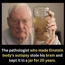 In 1955, after Albert Einstein's death, pathologist Dr. Thomas Stoltz  Harvey performed his autopsy and took his brain without permission,  believing it could reveal the secret to Einstein's genius. He preserved it