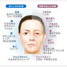 ボトックスとヒアルロン酸＊Allergan Campaign Awards 2018 : ～Dr.Fumiの美容Blog～