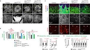 I decided to further my studies by completing vu's master of education because i ultimately want to be a principal. Dll4 And Notch Signalling Couples Sprouting Angiogenesis And Artery Formation Nature Cell Biology