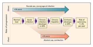 Hepatitis C