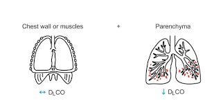 Image result for Diffusing Capacity