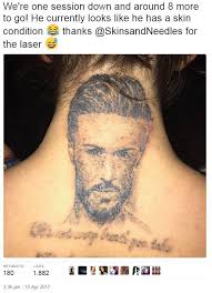 Holly Hagan shows off her fading Kyle Christie tattoo after getting vile  portrait of her ex-boyfriend lasered off her skin