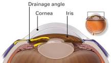 Image result for icd 10 code for anatomical narrow angle bilateral