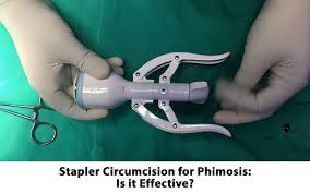 Image result for Phimosis