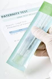 doctor holding buccal swab on paternity dna test result chart