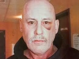 Defence to argue officer used reasonable force