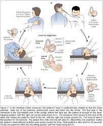 Dizziness And Vertigo Physical Therapy Vertigo Physical Therapist Assistant
