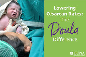 Image result for Doula