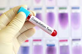 Gloved hand holding a blood sample tube labeled for coagulation tests in a laboratory setting
