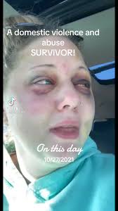 Carissa Bates Domestic Survivor Video