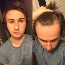 Face shape plays a paramount role in the process of picking a haircut. Hairstyle For My Face Shape Hairline Malehairadvice