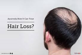 This condition is generally asymptomatic but can cause itching. Ayurveda How It Can Treat Hair Loss By Dr Mayur Surana Lybrate