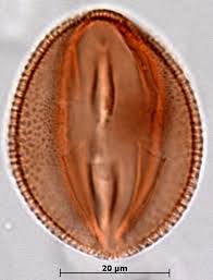 Image result for Micrargeria filiformis